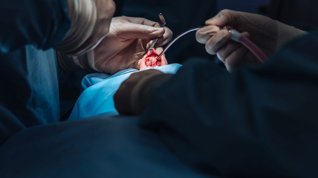 otorrinolaringologista em Perdizes São Paulo