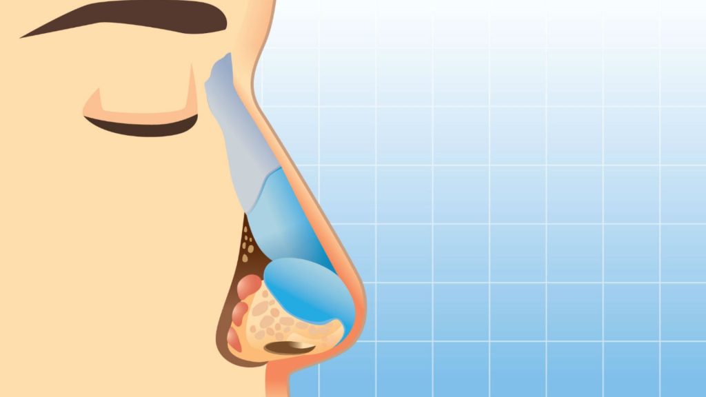 otorrinolaringologista em Perdizes São Paulo