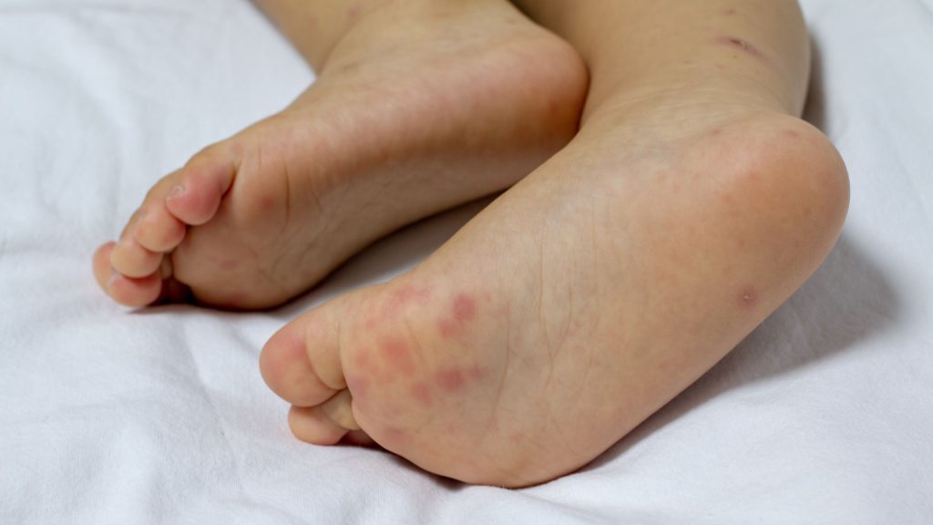 otorrinolaringologista pediátrico em São Paulo